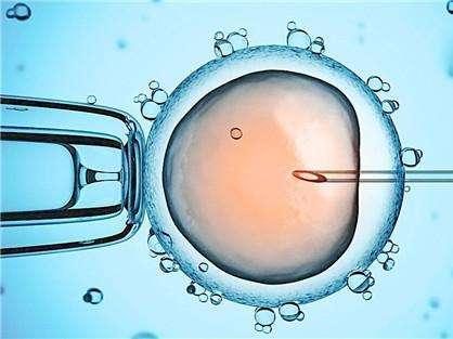 妇科微创